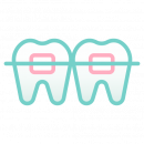 Брекет - системы - Стоматологическая клиника АВЕРОН